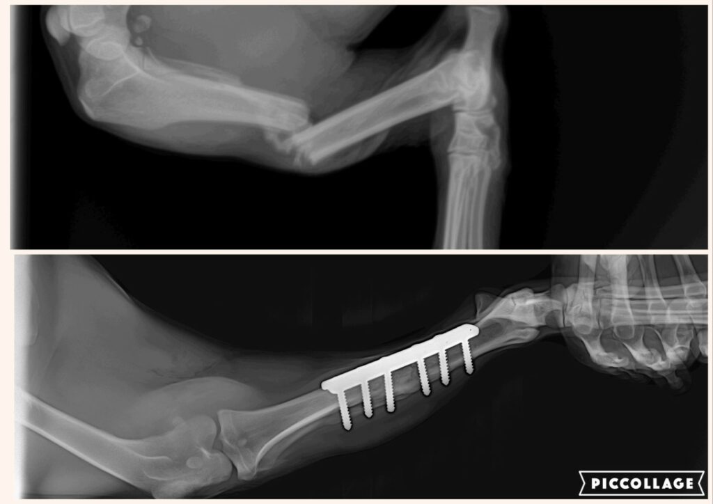 Zlomenina holenní kosti