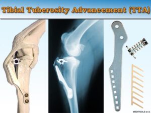 Ruptura předního křížového vazu – ilustrace